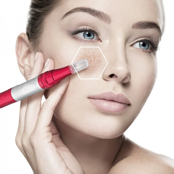 LCN micro needling facial